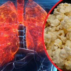 Płuca jak popcorn, czerwone i gorące, obok chrupiącej przekąski.