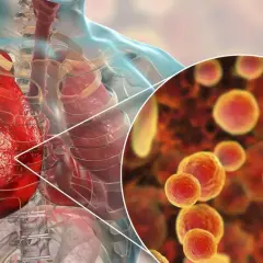 Ilustracja płuc człowieka z powiększeniem na bakterie Mycoplasma pneumoniae.