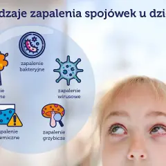 Grafika przedstawia rodzaje zapalenia spojówek u dzieci: alergiczne, bakteryjne, wirusowe, chemiczne i grzybicze. Widoczna jest też część twarzy dziecka z zaczerwienionym okiem.