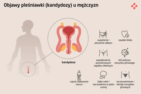Objawy kandydozy u mężczyzn: swędzenie i pieczenie odbytu, ból podczas stosunku, zaczerwienienie narządów płciowych.