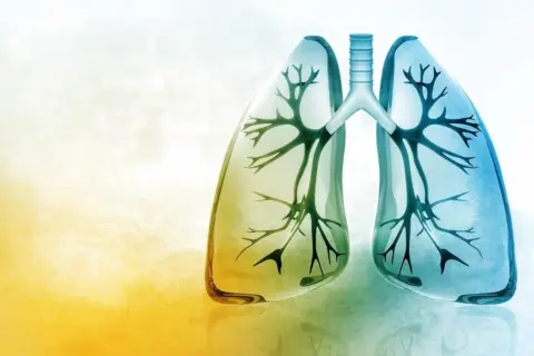 Ilustracja płuc z drzewem oskrzelowym w środku, w odcieniach żółci i błękitu.