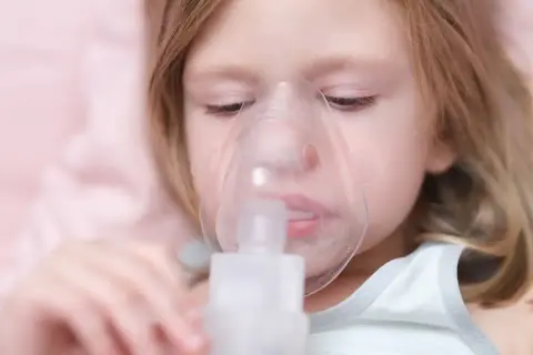 Dziewczynka z maską inhalatora na twarzy.