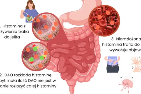 Histamina z pożywienia trafia do jelita, gdzie DAO próbuje ją rozłożyć. Nierozłożona histamina trafia do krwi, wywołując objawy.