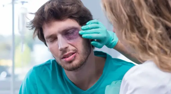 Mężczyzna z fioletowym siniakiem pod okiem, któremu pielęgniarka w zielonej rękawiczce ogląda uraz. Pytanie: co na siniaka pod okiem?