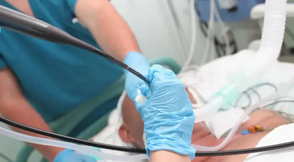 Lekarz wykonuje bronchoskopię u pacjenta podłączonego do respiratora. Czas pobytu w szpitalu po zabiegu jest różny.