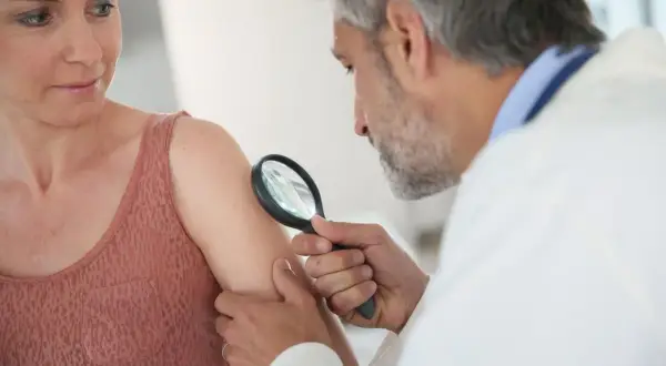 Dermatolog bada skórę pacjentki lupą, szukając oznak liszaja. Może to być początek leczenia maścią na liszaj.