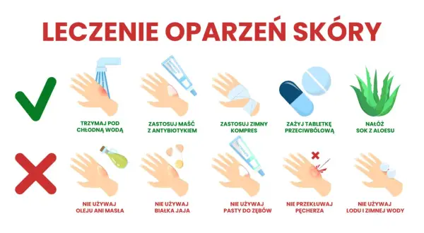 Porady co na oparzenia: chłodna woda, maść z antybiotykiem, zimny kompres, tabletki przeciwbólowe, sok z aloesu. Unikaj masła, jajka, pasty do zębów, lodu. Nie przekłuwaj pęcherzy.
