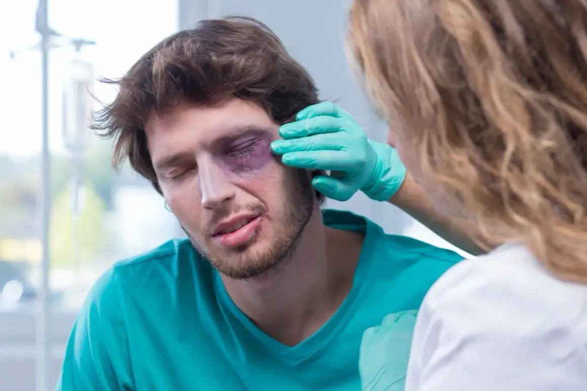 Mężczyzna z fioletowym siniakiem pod okiem, któremu pielęgniarka w zielonej rękawiczce ogląda uraz. Pytanie: co na siniaka pod okiem?