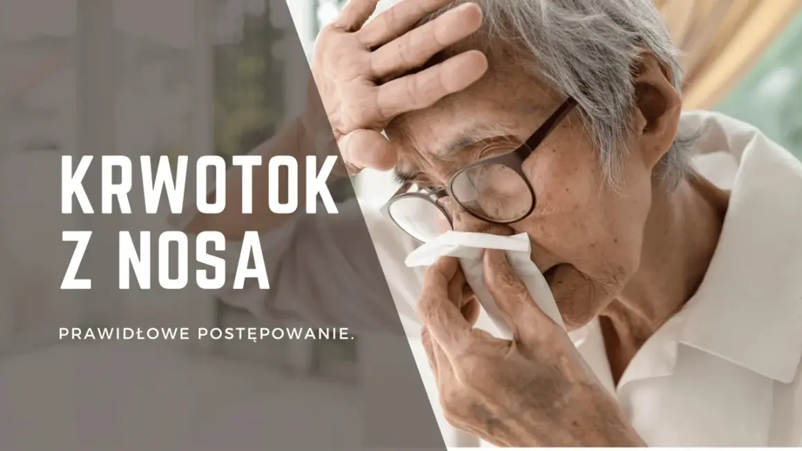 Starsza osoba z okularami przykłada chusteczkę do krwawiącego nosa.