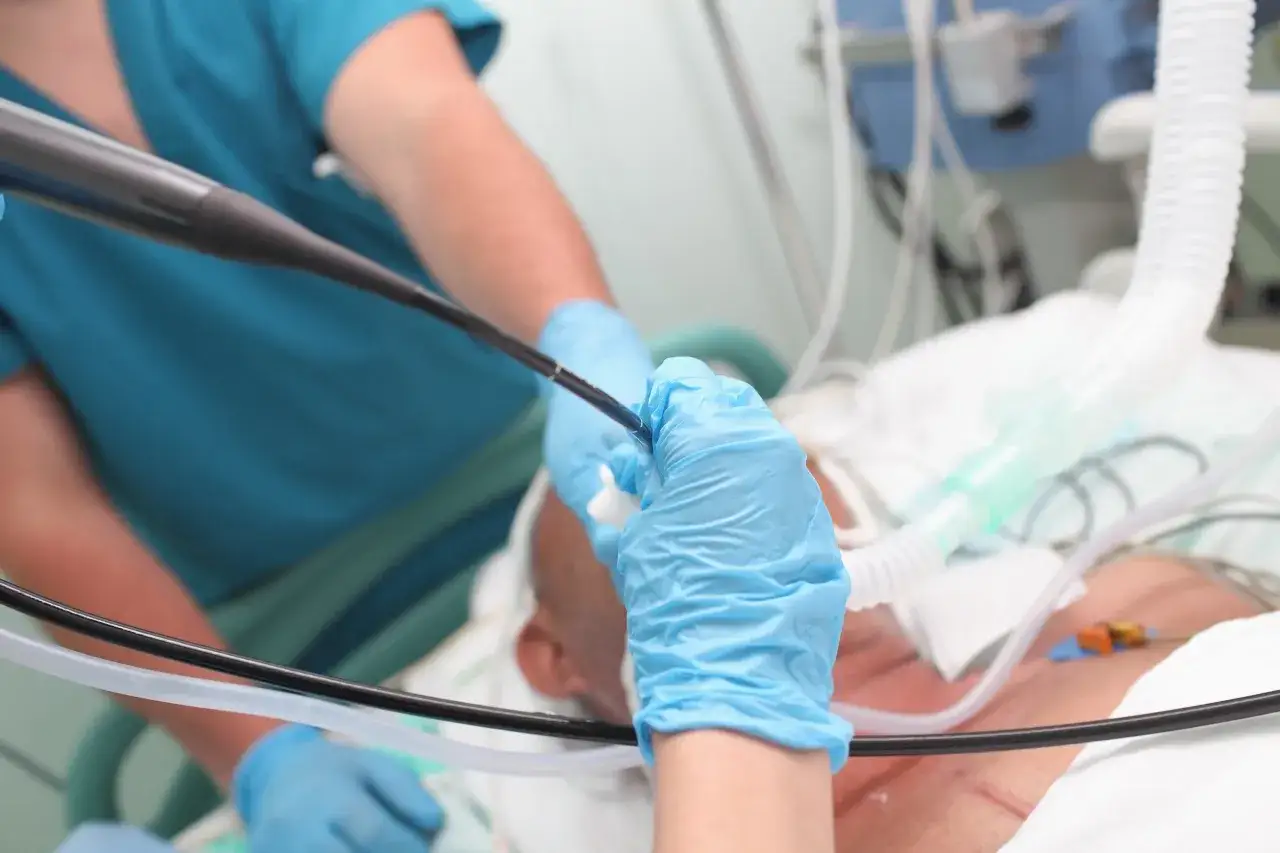 Lekarz wykonuje bronchoskopię. Czas pobytu w szpitalu po zabiegu zależy od stanu pacjenta.
