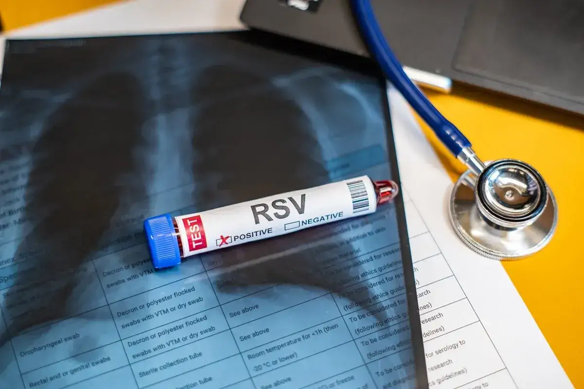 Test RSV z zaznaczonym wynikiem