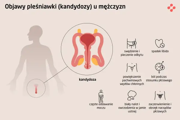 Objawy kandydozy u mężczyzn: swędzenie i pieczenie odbytu, ból podczas stosunku, zaczerwienienie narządów płciowych.