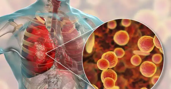 Ilustracja płuc człowieka z powiększeniem na bakterie Mycoplasma pneumoniae.