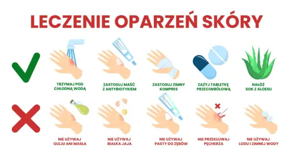 Porady co na oparzenia: chłodna woda, maść z antybiotykiem, zimny kompres, tabletki przeciwbólowe, sok z aloesu. Unikaj masła, jajka, pasty do zębów, lodu. Nie przekłuwaj pęcherzy.
