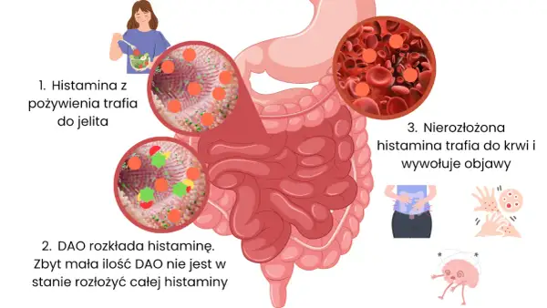 Histamina z pożywienia trafia do jelita, gdzie DAO próbuje ją rozłożyć. Nierozłożona histamina trafia do krwi, wywołując objawy.